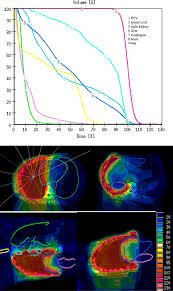 We did not find results for: Evaluating Target Coverage And Normal Tissue Sparing In The Adjuvant Radiotherapy Of Malignant Pleural Mesothelioma Helical Tomotherapy Compared With Step And Shoot Imrt Radiotherapy And Oncology