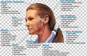 Bruxism Temporomandibular Joint Dysfunction Dentistry Jaw Png Clipart Ache Bruxism Chin Dentin Hypersensitivity Dentist Free Png