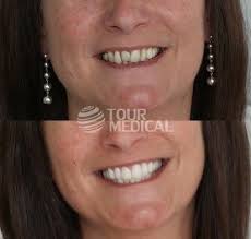 pin by bruchsal zahnarztpraxis on zahnarzt bruchsal dental fotos dental posts dental diamond earrings