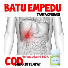 Membantu kerja dan fungsi enzim pencernaan. Obat Batu Empedu Penyakit Cairan Empedu Biolipid Naturindo Cod Shopee Indonesia