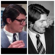 In the December 1980 photo at right, Reeve's hair contains a totally  different part than his Clark Kent hair from earlier that year. Evidence  suggests that Reeve may have worn partial hairpieces