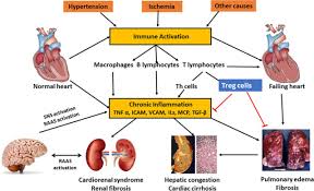 Pericarditis is often used interchangeably with myocarditis and refers to inflammation of the. Inflammation In Heart Failure Hypertension