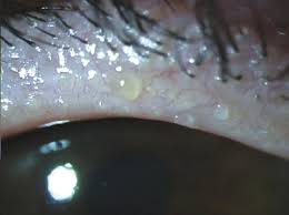 Image result for Blepharis bainesii