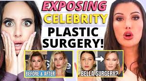 Celebrity Plastic Surgery