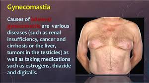 However, some breast cancer tumors. Breast Cancer In Men Youtube
