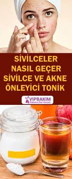 Sivilce Nasil Gecer Sivilceler Icin Cok Etkili Maske Tarifleri Vipbakim Dogal Saglik Dogal Cilt Bakimi Evde Hazirlabilen Ilaclar