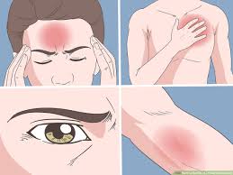 4 Ways To Get Rid Of A Headache Naturally Wikihow