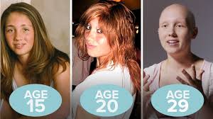 Hair will start to regrow on its own two to three weeks after chemotherapy is completed. Women Who Lost Their Hair After Chemotherapy Share Their Stories Allure
