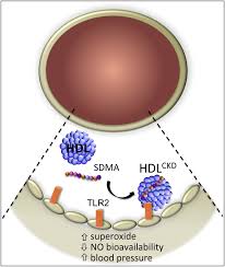 Dysfunctional HDL Takes Its Toll in Chronic Kidney Disease: Immunity