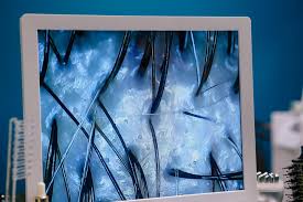 See your scalp's health with this luxury head spa treatment - Los Angeles  Times