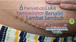 Pesanan leaders sy, masa dalam pantang, kena jaga part bwh tu elok2. Luka Bersalin Lambat Sembuh
