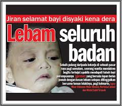 Hasil carian imej untuk KES DERA KANAK-KANAK DAN BAYI