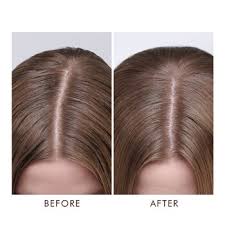 If you have dryness of the scalp, you have mostly dealt with an uncontrollable sense of itchiness. Dry Scalp Treatment Moroccanoil Sephora