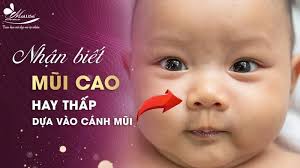 3 Cách Nhận Biết Trẻ Sơ Sinh Mũi Cao Hay Thấp HOT 2024