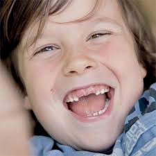 تفسير حلم ولادة طفل له اسنان لابن سيرين. Ø§Ù„Ø£Ø³Ù†Ø§Ù† Ø§Ù„Ù„Ø¨Ù†ÙŠØ© Ø§Ù„Ù…Ø³Ùˆ Ø³Ø© ÙŠÙØ¶ Ù„ Ø®Ù„Ø¹Ù‡Ø§ Ù„Ø¯Ù‰ Ø§Ù„Ø·Ø¨ÙŠØ¨ Ø­ÙŠØ§ØªÙ†Ø§ Ù…Ù„Ø§Ù…Ø­ Ø§Ù„Ø¥Ù…Ø§Ø±Ø§Øª Ø§Ù„ÙŠÙˆÙ…