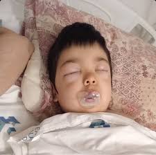 URGENTE: AJUDE A SALVAR A VIDA DO PEQUENO DAVI! O Davi é uma criança  Autista de 5 anos, diagnosticada com Síndrome Nefrótica e que apresentou  complicações nos rins. Na cidade onde ele