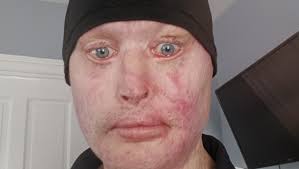 Fundraiser by Michael Targouski : Stand with Michael: 10 Months in Hospital