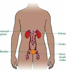 Testicular cancer has a very fast onset. Testicular Cancer And The Lymph Nodes Macmillan Cancer Support