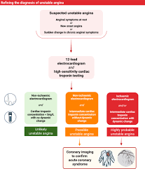 Image result for Unstable Angina