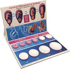 Cervix dilation is a critical part of labour, so your baby can be born. Amazon Com Cervical Effacement Dilation Model Health Personal Care