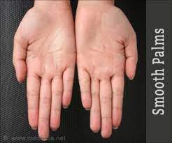 Smoothen Those Rough Palms Beauty Tips How To Soften Hands Natural Nail Shapes Hand Scrub Diy