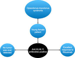 Genetics family history age radiation obesity hormone therapy after menopause. Opsoclonus Myoclonus Syndrome Associated With Anti Kelch Like Protein 11 Antibodies In A Young Female Patient Without Cancer Sciencedirect