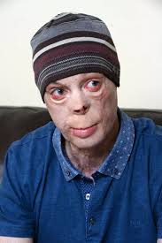 Brave disabled veterans set record by climbing Mount Everest and skydiving  near peak