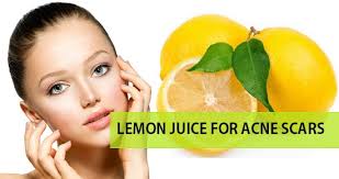 Homeremedies To Use Lemon Juice For Acne Scars Pimple Marks