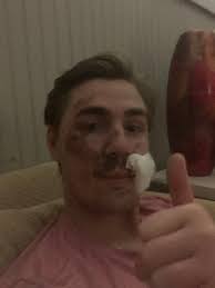 First year sober. It's been a journey. I realized I had a serious problem  at 22. Being a functional, care free, mininnal consequence, somewhat  thriving alcoholic for years had run its course.