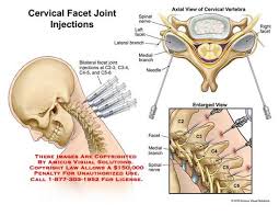They are the small joints that help you bend and twist. Cervical Facet Joint Injections Imagenes De Medicos Fibromialgia Anatomia