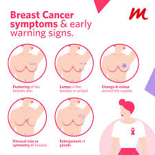 Thickening or swelling of part of the breast. Facebook