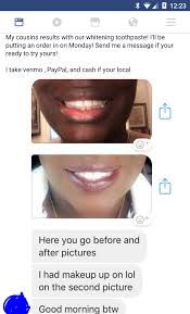 There are dozens of toothpaste brands on the market, and they offer different formulas for different oral care needs. How Long Does Teeth Whitening Last Reddit Teethwalls