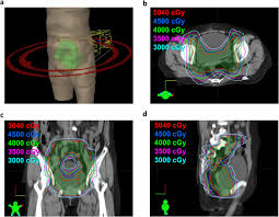 A biopsy is most often the only certain way to tell if cancer is present. Impact Of Adjuvant Radiotherapy On The Survival Of Women With Optimally Resected Stage Iii Endometrial Cancer In The Era Of Modern Radiotherapy A Retrospective Study Radiation Oncology Full Text