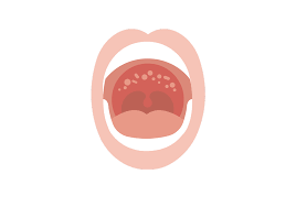 Check spelling or type a new query. Pain And Sore Roof Of Mouth 4 Causes Treatments