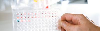 Results will be available as soon as analysis is completed. Bioscientia Mvz Labor Saar Gmbh