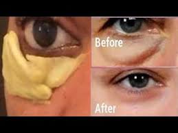 If you do, wash your cucumber before. Easy Remedy To Remove Eye Bag And Puffy Eye Fast Youtube Remove Eye Bags Eye Bags Treatment Eye Bags