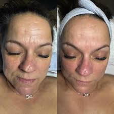 Marisa Vitale (@lashviperaesthetics) • Instagram photos and videos