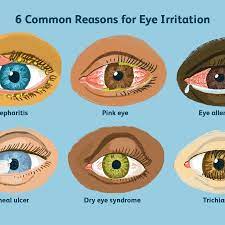 Top 6 Reasons For Eye Irritation