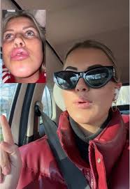 Verpeste Lippen: Twee Jaar na Lip Fillers