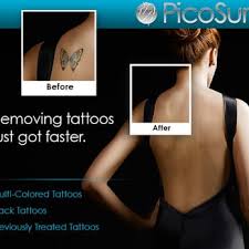 With the latest picosecond lasers, we can even remove lighter colours like pink, red, green and brown as seen here where the lighter coloured lower tattoo was removed using the picosecond laser. Inklifters Tattoo Removal Tattoo Removal 1865 W Pleasant Grove Blvd Pleasant Grove Ut Phone Number