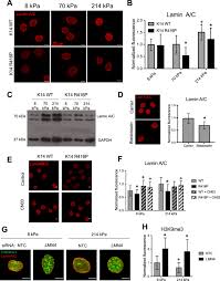 Faktor politik yang mempengaruhi trend eksport malaysia; The Keratin Network Of Intermediate Filaments Regulates Keratinocyte Rigidity Sensing And Nuclear Mechanotransduction Science Advances