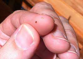 Image result for red mite