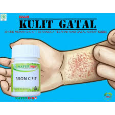 Meskipun menyerupai nyamuk, mereka bisa menyebabkan. Obat Herbal Kulit Gatal Bintik Merah Digigit Serangga Telapak Kaki Gatal Obat Kurap Obat Kudis Shopee Indonesia