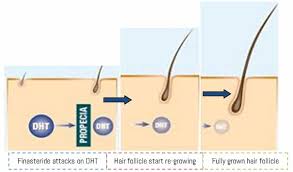 We disqualified the ones with unnecessary, synthetic fillers and those whose contents differed drastically from pill to pill. Finasteride Dosage Uses Side Effects For Hair Loss Ak Clinics