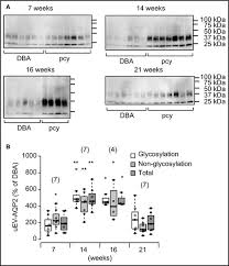We have 6 pictures about u 12 kawanishi riko 画像 including images, pictures don't forget to bookmark u 12 kawanishi riko 画像 using ctrl + d (pc) or command + d (macos). A Bell Shaped Pattern Of Urinary Aquaporin 2 Bearing Extracellular Vesicle Release In An Experimental Model Of Nephronophthisis Mikoda 2019 Physiological Reports Wiley Online Library