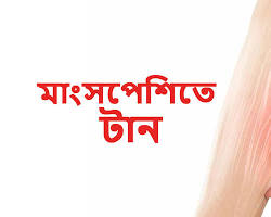Image of পেশীতে টান