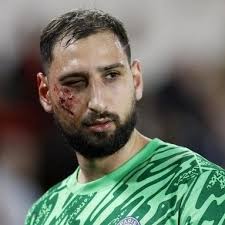 TREMENDO el PLANCHAZO que le dieron a Gigi Donnarumma EN LA CARA, en pleno  Mónaco-PSG 😳🇫🇷