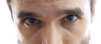 Blefaroplastia Para Homens Dr Ricardo Maniglia Curitiba