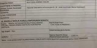 We did not find results for: Babamin Tek Gozu Gormuyor Otv Indirimi Alabilirmi Sayfa 1 3