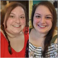 Women embracing healing and self care